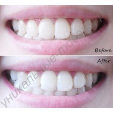 Отбеливающие полоски для зубов CREST WHITESTRIPS 3D (1 пара - для верхнего и нижнего рядов зубов)
